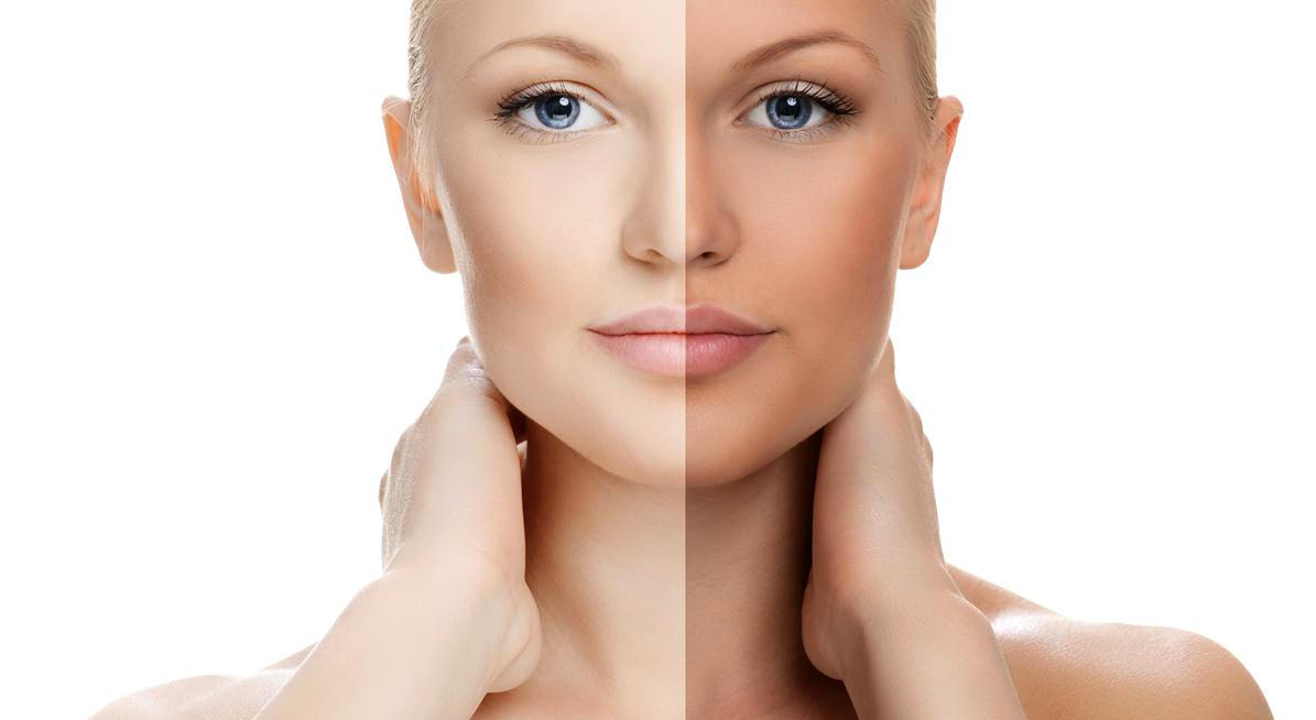 Come eliminare l'abbronzatura